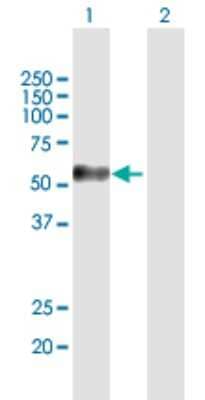 Western Blot: Melanoma antigen family C2 Antibody [H00051438-B01P] - Analysis of MAGEC2 expression in transfected 293T cell line by MAGEC2 polyclonal antibody.  Lane 1: MAGEC2 transfected lysate(41.03 KDa). Lane 2: Non-transfected lysate.