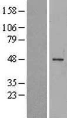 Western Blot: Melanoma antigen family C2 Overexpression Lysate (Adult Normal) [NBL1-12813] Left-Empty vector transfected control cell lysate (HEK293 cell lysate); Right -Over-expression Lysate for Melanoma antigen family C2.