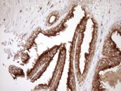 Immunohistochemistry: Melanophilin Antibody (6E8) [NBP2-45883] - Analysis of Human prostate tissue. (Heat-induced epitope retrieval by 1mM EDTA in 10mM Tris buffer (pH8.5) at 120C for 3 min)