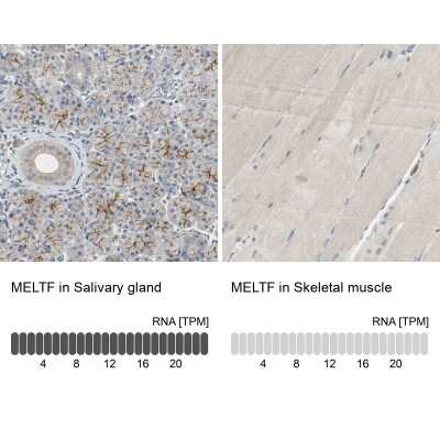 Immunohistochemistry-Paraffin Melanotransferrin/CD228/MFI2 Antibody - BSA Free