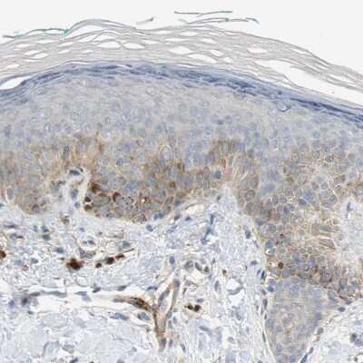 Immunohistochemistry-Paraffin: Melanotransferrin/CD228/MFI2 Antibody [NBP1-85777] - Staining of human skin shows weak to moderate cytoplasmic positivity in keratinocytes.