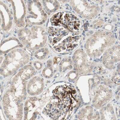 Immunohistochemistry-Paraffin: Melanotransferrin/CD228/MFI2 Antibody [NBP1-85777] - Staining of human kidney shows moderate to strong membranous positivity in cells in glomeruli.