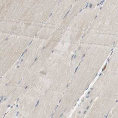 Immunohistochemistry-Paraffin: Melanotransferrin/CD228/MFI2 Antibody [NBP1-85777] - Staining of human skeletal muscle shows no positivity in myocytes.