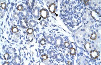 Immunohistochemistry: Membralin Antibody [NBP2-87796] - Human kidney