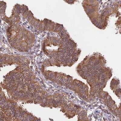 Immunohistochemistry-Paraffin: Membralin Antibody [NBP1-90088] - Staining of human Fallopian tube shows strong cytoplasmic positivity in glandular cells.