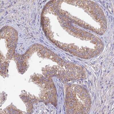 Immunohistochemistry-Paraffin: Membralin Antibody [NBP1-90088] - Staining of human prostate shows moderate granular cytoplasmic positivity in glandular cells.