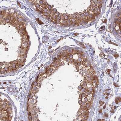 Immunohistochemistry-Paraffin: Membralin Antibody [NBP1-90088] - Staining of human testis shows strong granular cytoplasmic positivity in cells in seminiferous ducts.