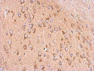 Immunohistochemistry-Paraffin: Membralin Antibody [NBP2-17276] - Immunohistochemical analysis of paraffin-embedded CL1-5 xenograft, using antibody at 1:500 dilution.