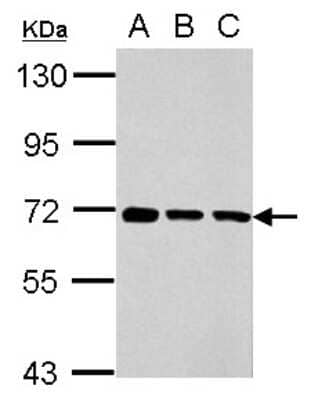 Western Blot: Membralin Antibody [NBP2-17276] - Sample (30 ug of whole cell lysate) A: K562 B: THP-1 C: HL-60 7. 5% SDS PAGE gel, diluted at 1:10000.
