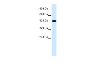 Western Blot: Membralin Antibody [NBP2-87796] - WB Suggested Anti-C19ORF6 Antibody Titration: 1.0ug/ml. ELISA Titer: 1:62500. Positive Control: Jurkat cell lysateTMEM259 is strongly supported by BioGPS gene expression data to be expressed in Human Jurkat cells