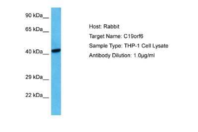 Western Blot: Membralin Antibody [NBP2-87798] - Host: Rabbit. Target Name: C19ORF6. Sample Tissue: Human THP-1 Whole Cell lysates. Antibody Dilution: 1ug/ml
