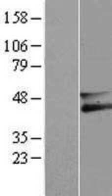 Western Blot: Membralin Overexpression Lysate (Adult Normal) [NBL1-08281] Left-Empty vector transfected control cell lysate (HEK293 cell lysate); Right -Over-expression Lysate for Membralin.