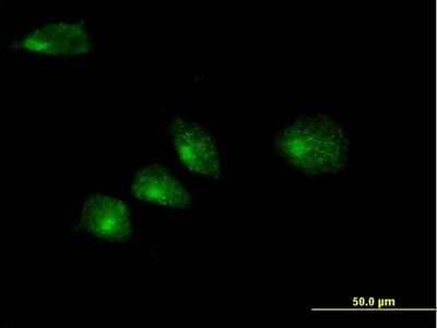 Immunocytochemistry/Immunofluorescence: Membrin Antibody [H00009570-B01P] - Analysis of purified antibody to GOSR2 on HeLa cell. (antibody concentration 10 ug/ml)