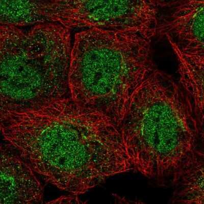 Immunocytochemistry/Immunofluorescence: Membrin Antibody [NBP2-47379] - Immunofluorescent staining of human cell line A-431 shows localization to nucleoplasm, cytosol & the Golgi apparatus.