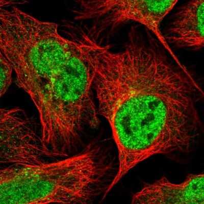 Immunocytochemistry/Immunofluorescence: Membrin Antibody [NBP2-54985] - Staining of human cell line U-2 OS shows localization to nucleoplasm & the Golgi apparatus.