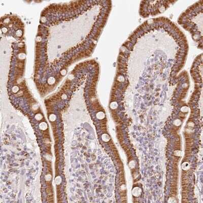 Immunohistochemistry-Paraffin: Membrin Antibody [NBP2-47379] - Staining of human duodenum shows strong granular cytoplasmic positivity in glandular cells.