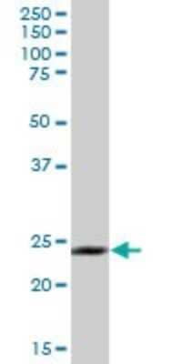 Western Blot: Membrin Antibody [H00009570-B01P] - Analysis of GOSR2 expression in human stomach.