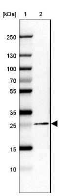 Western Blot: Membrin Antibody [NBP2-47379] - Lane 1: Marker  [kDa] 250, 130, 100, 70, 55, 35, 25, 15, 10.  Lane 2: Human cell line CACO-2