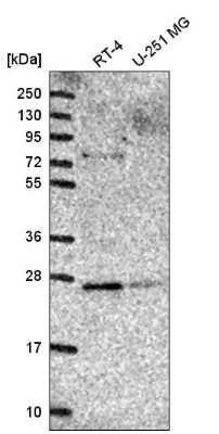 Western Blot: Membrin Antibody [NBP2-54985] - Western blot analysis in human cell line RT-4 and human cell line U-251 MG.