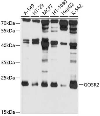 Western Blot: Membrin Antibody [NBP3-03314] - Analysis of extracts of various cell lines, using Membrin antibody at 1:1000 dilution. Secondary antibody: HRP Goat Anti-Rabbit IgG (H+L) at 1:10000 dilution. Lysates/proteins: 25ug per lane. Blocking buffer: 3% nonfat dry milk in TBST. Detection: ECL Basic Kit.