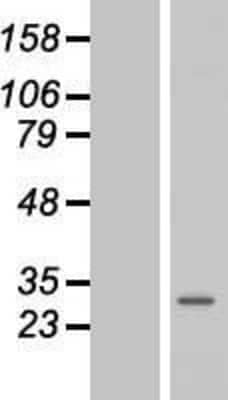 Western Blot: Membrin Overexpression Lysate (Adult Normal) [NBL1-11206] Left-Empty vector transfected control cell lysate (HEK293 cell lysate); Right -Over-expression Lysate for Membrin.