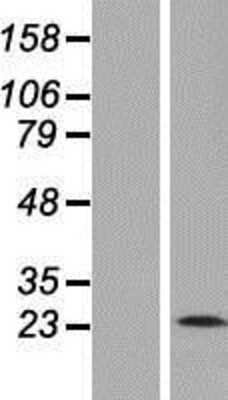 Western Blot: Membrin Overexpression Lysate (Adult Normal) [NBP2-05820] Left-Empty vector transfected control cell lysate (HEK293 cell lysate); Right -Over-expression Lysate for Membrin.