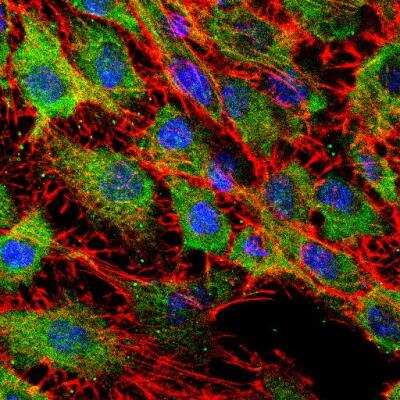 Immunocytochemistry/Immunofluorescence: Memory Loss Antibody Pack [NBP1-78951] - Confocal analysis of C6 cells using PGP9.5 / UCHL-1 antibody (NB300-675, 1:5). An Alexa Fluor 488-conjugated Goat to rabbit IgG was used as secondary antibody (green). Actin filaments were labeled with Alexa Fluor 568 phalloidin (red). DAPI was used to stain the cell nuclei (blue). Image from verified customer review.