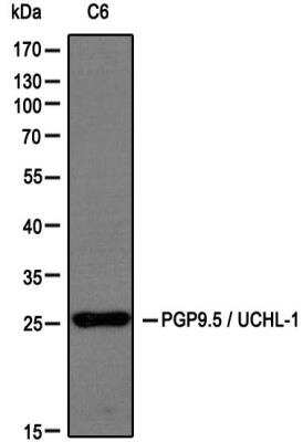 Western Blot: Memory Loss Antibody Pack [NBP1-78951] - Analysis of extracts from C6 cells using PGP9.5 / UCHL-1 antibody (NB300-675, 1:200). Image from verified customer review.