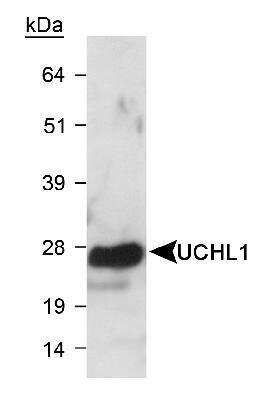 Western Blot: Memory Loss Antibody Pack [NBP1-78951] - Detection of UCHL1 using NB300-675 in mouse brain lysate.