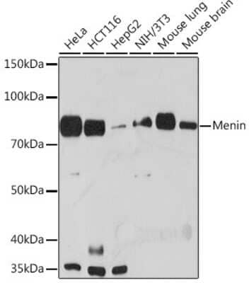 Western Blot: Menin Antibody (5M7L9) [NBP3-16180] - Western blot analysis of extracts of various cell lines, using Menin Rabbit mAb (NBP3-16180) at 1:1000 dilution. Secondary antibody: HRP Goat Anti-Rabbit IgG (H+L) at 1:10000 dilution. Lysates/proteins: 25ug per lane. Blocking buffer: 3% nonfat dry milk in TBST. Detection: ECL Basic Kit. Exposure time: 90s.