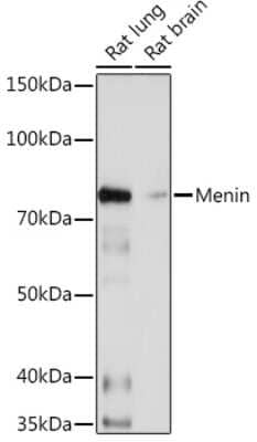 Western Blot: Menin Antibody (5M7L9) [NBP3-16180] - Western blot analysis of extracts of various cell lines, using Menin Rabbit mAb (NBP3-16180) at 1:1000 dilution. Secondary antibody: HRP Goat Anti-Rabbit IgG (H+L) at 1:10000 dilution. Lysates/proteins: 25ug per lane. Blocking buffer: 3% nonfat dry milk in TBST. Detection: ECL Basic Kit. Exposure time: 3min.