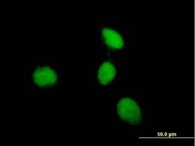 Immunocytochemistry/Immunofluorescence: Menin Antibody [H00004221-B01P] - Analysis of purified antibody to MEN1 on HeLa cell. (antibody concentration 10 ug/ml)