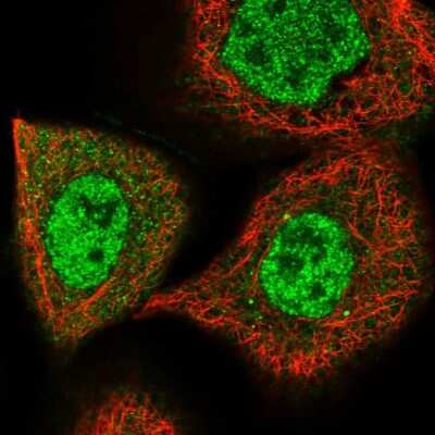 Immunocytochemistry/Immunofluorescence: Menin Antibody [NBP1-90357] - Immunofluorescent staining of human cell line A-431 shows localization to nucleoplasm & cytosol.