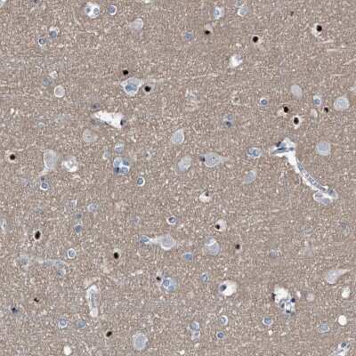 Immunohistochemistry-Paraffin: Menin Antibody [NBP1-90357] - Staining of human cerebral cortex shows strong nuclear positivity in glial cells.