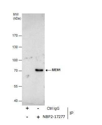 Immunoprecipitation: Menin Antibody [NBP2-17277] - Immunoprecipitation of MEN1 protein from 293T whole cell extracts using 5 ug of Menin antibody [N1C1]. Western blot analysis was performed using Menin antibody [N1C1]. EasyBlot anti-Rabbit IgG was used as a secondary reagent.