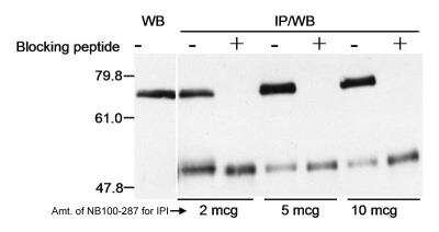 Western Blot: Menin Antibody [NB100-287] - Samples: Whole cell lysate (40 ug for WB; one 10 cm plate 293T cells for IP) from 293T cells.   Affinity purified goat anti-Menin used as indicated for IP.  Menin was detected by Western Blot using affinity purified rabbit anti-Menin NB100-215 at 0.1 ug/ml for WB.  Detection: Chemiluminescence exposed for 1 minute.