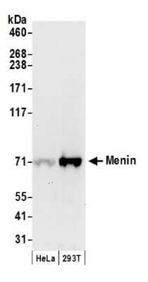 <b>Biological Strategies Validation. </b>Western Blot: Menin Antibody [NB100-287] - Samples: Whole cell lysate (50 ug) from HeLa and 293T cells prepared using NETN lysis buffer. Antibody: Affinity purified goat anti-Menin antibody used for WB at 0.1 ug/ml. Detection: Chemiluminescence with an exposure time of 30 seconds.