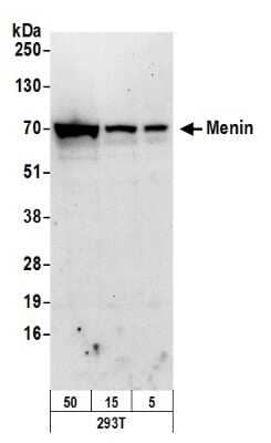 Western Blot: Menin Antibody [NB100-287] - Using the Biotin direct conjugate Samples: Whole cell lysate from HEK 293T (50, 15, and 5 ug). Antibody: Affinity purified, biotin-conjugated, goat anti-Menin antibody used at 1.0 ug/ml. Detection: Streptavidin-HRP and chemiluminescence with an exposure time of 30 seconds.