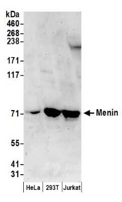 <b>Biological Strategies Validation. </b>Western Blot: Menin Antibody [NB100-399] - Samples: Whole cell lysate (50 ug) from HeLa, 293T, and Jurkat cells prepared using NETN lysis buffer. Antibodies: Affinity purified rabbit anti-Menin antibody used for WB at 2 ug/ml. Detection: Chemiluminescence with an exposure time of 3 minutes.