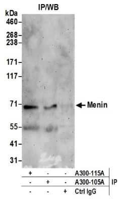 Western Blot: Menin Antibody [NB100-399] - Samples: Whole cell lysate (0.5 or 1.0 mg per IP reaction; 20% of IP loaded) from HeLa cells prepared using NETN lysis buffer. Antibodies: Affinity purified rabbit anti-Menin antibody (lot was used at 2 ug/ml. Detection: Chemiluminescence with an exposure time of 3 minutes.