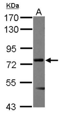 Western Blot: Menin Antibody [NBP2-17277] - Sample (30 ug of whole cell lysate) A: Raji 7. 5% SDS PAGE gel, diluted at 1:500.