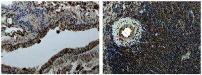 Immunohistochemistry-Paraffin: Mer Antibody (3D07) [NB110-94148] - Mer immunohistochemistry staining of paraffin sections of mouse lung and spleen tissues from LPS exposed animals.