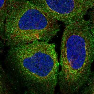 Immunocytochemistry/Immunofluorescence: Mer Antibody [NBP2-58025] - Staining of human cell line U-2 OS shows localization to plasma membrane & endoplasmic reticulum. Antibody staining is shown in green.