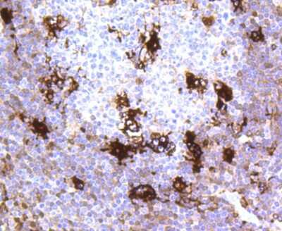 Immunohistochemistry-Paraffin: Mer Antibody (SR29-07) [NBP2-67323] - Analysis of paraffin-embedded human tonsil tissue using anti-MERTK antibody. Counter stained with hematoxylin.