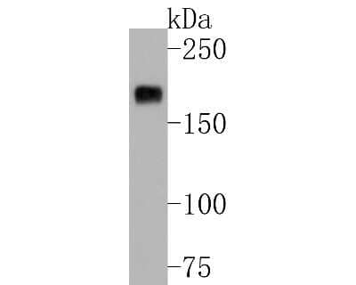 Western Blot: Mer Antibody (SR29-07) [NBP2-67323] - Western blot analysis of Mer on 293T cell lysates. Proteins were transferred to a PVDF membrane and blocked with 5% BSA in PBS for 1 hour at room temperature. The primary antibody (1/500) was used in 5% BSA at room temperature for 2 hours. Goat Anti-Rabbi