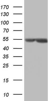 Western Blot: Mesothelin Antibody (8H7) [NBP2-45797] - Analysis of HEK293T cells were transfected with the pCMV6-ENTRY control (Left lane) or pCMV6-ENTRY Mesothelin.