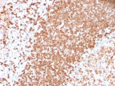 Immunohistochemistry-Paraffin: Mesothelin Antibody (TCL1/2747R) - Azide and BSA Free [NBP3-08384] - Formalin-fixed, paraffin-embedded human Tonsil stained with Mesothelin Recombinant Rabbit Monoclonal Antibody (Mesothelin/2747R).
