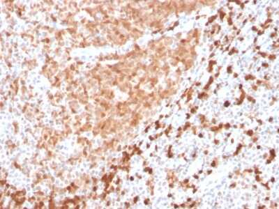 Immunohistochemistry-Paraffin: Mesothelin Antibody (TCL1/2747R) - Azide and BSA Free [NBP3-08384] - Formalin-fixed, paraffin-embedded human Tonsil stained with Mesothelin Recombinant Rabbit Monoclonal Antibody (Mesothelin/2747R).