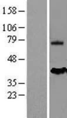 Western Blot Mesothelin Overexpression Lysate