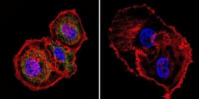 Immunocytochemistry/Immunofluorescence: Mesothelioma Antibody (ME1) [NBP2-22442] - Analysis of Mesothelioma in MCF-7 cells. Cells were grown on chamber slides and fixed with formaldehyde prior to staining. Cells were probed without (control) or with a Mesothelioma monoclonal antibody at a dilution of 1:20 overnight at 4C, washed with PBS and incubated with a DyLight-488 conjugated secondary antibody. Mesothelioma staining (green), F-Actin staining with Phalloidin (red) and nuclei with DAPI (blue) is shown.